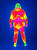 Obese woman,thermogram