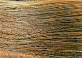 Nits (head louse eggs) in human hair