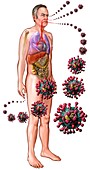 Routes of infection for SARS virus