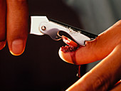 Torture: using a tin-opener on a human fingernail