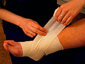 Applying bandage to sprained ankle