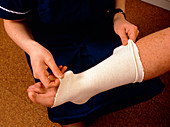 Applying bandage to sprained ankle