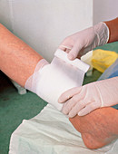Bandages being applied to leg ulcer