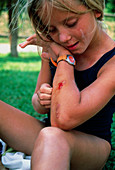 Ten year old girl examining a cut on her arm