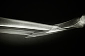 Broken leg,X-ray