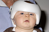 Helmet to treat plagiocephaly