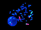 Chromosome 2:3 translocation