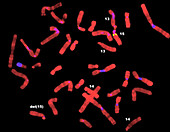 FISH micrograph of Prader-Willi chromosomes