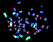 FISH micrograph of abnormal chromosomes