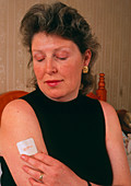 Woman placing nicotine patch on arm