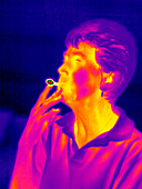 Smoking,thermogram