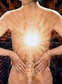 Computer artwork depicting back pain in a woman