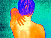 Neck pain,thermogram