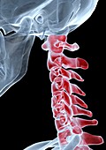 Neck pain,X-ray artwork