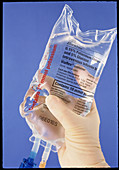 Gloved hand holding an intravenous drip bag