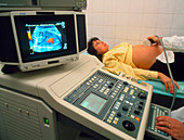 Doppler ultrasound of a pregnant woman