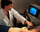 Ultrasound scanning of breast to locate a cyst