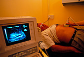 Ultrasound scanning of aortic artery in a man