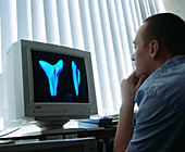 Uterus,ultrasound scan