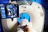 CT scanning