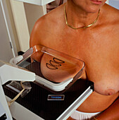 Woman patient undergoing mammogram