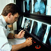 Examining X-rays