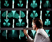Doctor examines breast mammograms on a lightbox