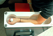 Bone-density scanning of a woman's arm