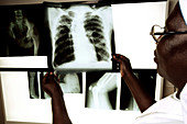 Radiographer looking at X-rays