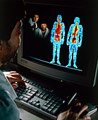 Doctors studying whole body gamma camera scans