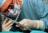 Laparoscopy examination