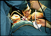 Gloved hands position a laparoscope during surgery