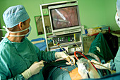 Laparoscopy