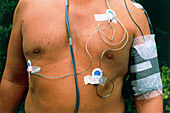 Torso of a man wearing a portable ECG machine