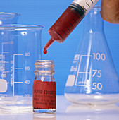 Blood sample undergoes testing