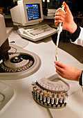 Hand pipetting a blood sample prior to analysis