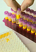 Monolisa EIA test for hepatitis C