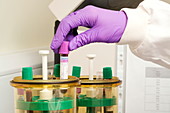 Blood centrifuge preparation