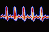 Heartbeat trace