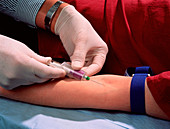 Blood sampling