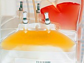 Blood bag containing platelets (yellow)