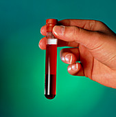 Test-tube containing blood sample