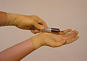 Gloved hand pricked during blood sampling