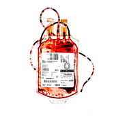 Empty blood bag