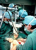 Surgeons using a stereo microscope