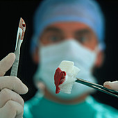 Blood-stained scalpel & gauze held by surgeon