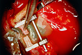 Microsurgery