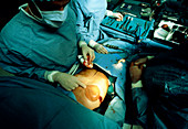 Woman undergoing breast reconstruction surgery