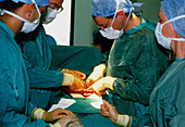 Surgeons performing exploratory bowel surgery