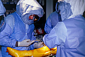 Surgical team performing knee replacement surgery
